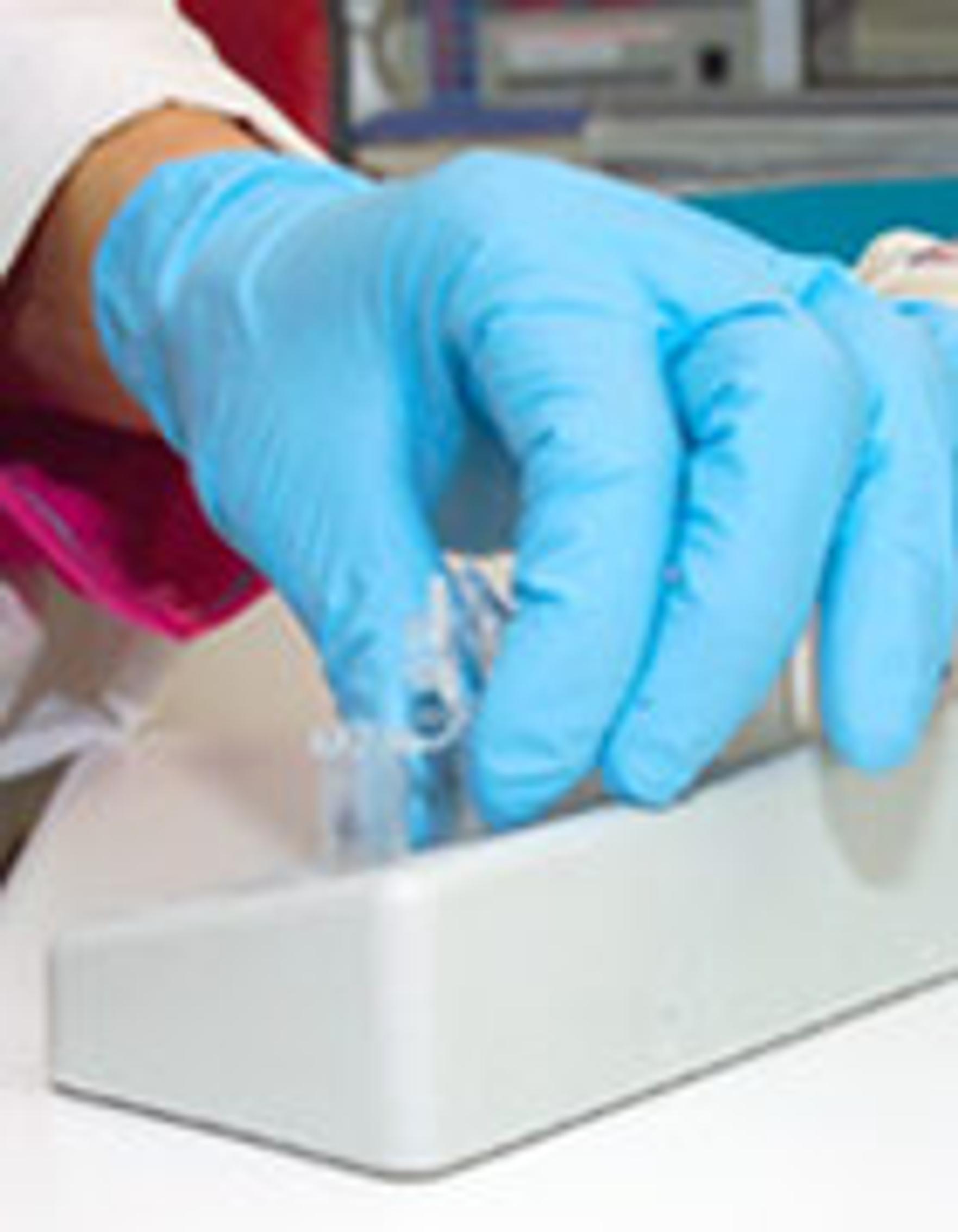 Autoimmuunisairaudet ovat yhteydessä Hodgkinin tautiin