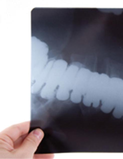 Liika rasvahapon saanti voi olla terveysriski Terve.fi