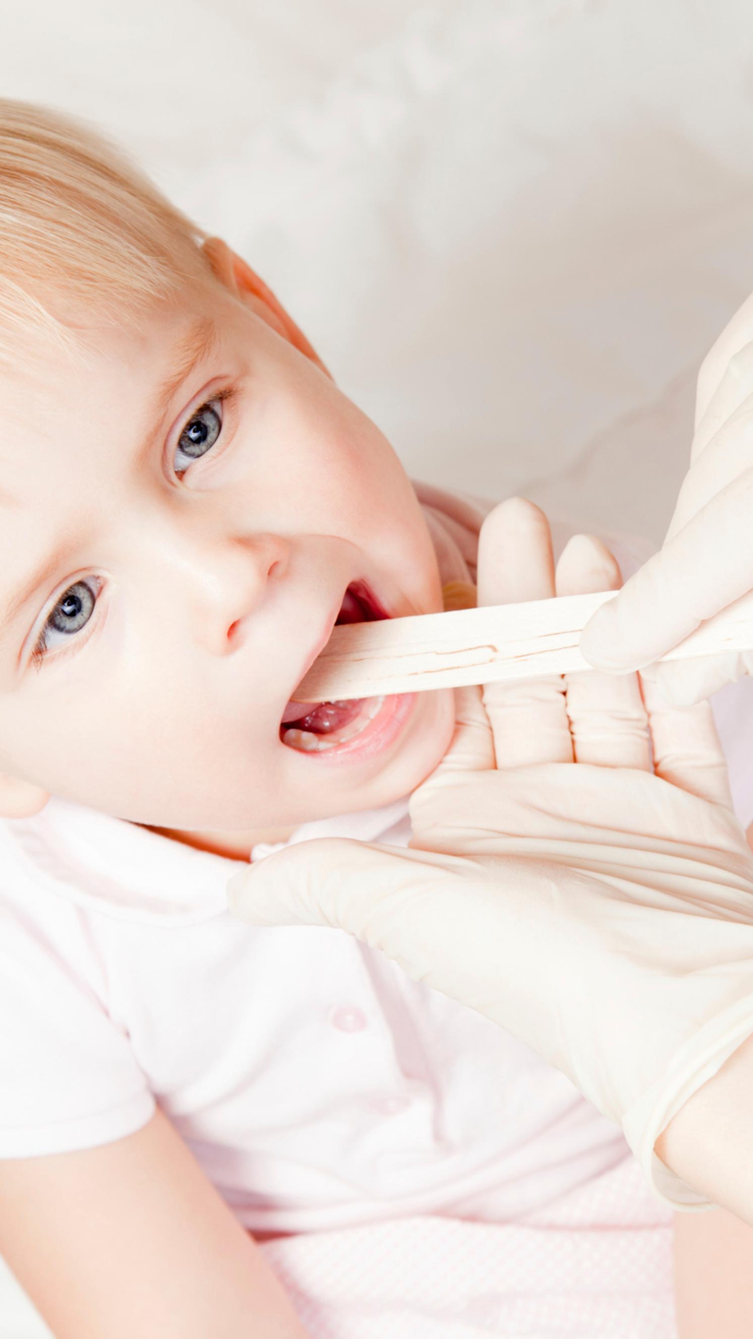 Angiina Eli Streptokokki A Bakteerin Aiheuttama Nielutulehdus