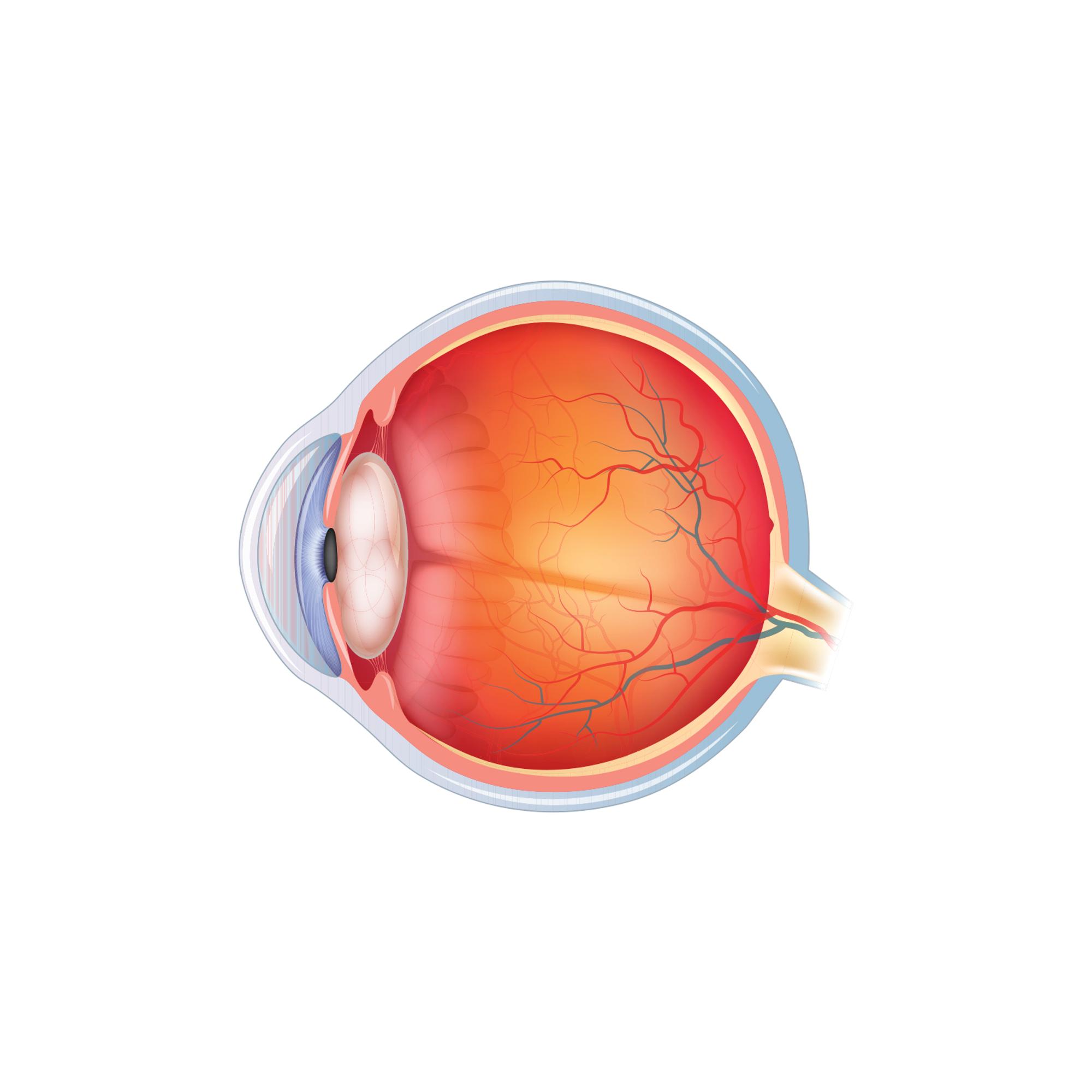 Часть сосудистой оболочки глазного яблока. Сосудистая оболочка глаза. Отделы сосудистой оболочки глазного яблока. Отслоение сетчатки глаза. Ретинит офтальмология.